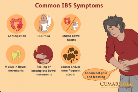 Hội chứng IBS