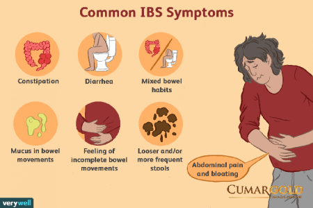 Hội chứng IBS