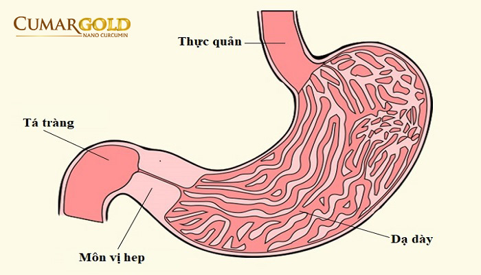 Hẹp môn vị 