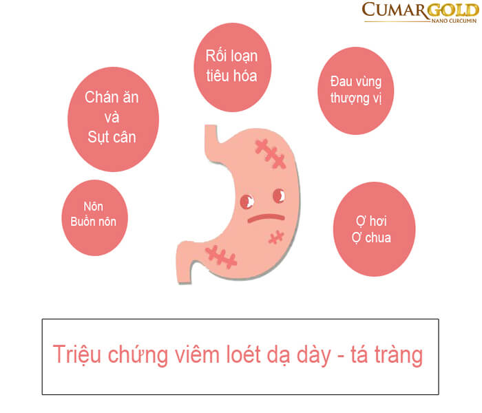 các triệu chứng viêm loét dạ dày tá tràng