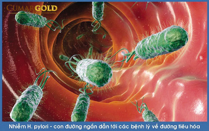 Vi khuẩn hp là gì? Hình ảnh minh họa